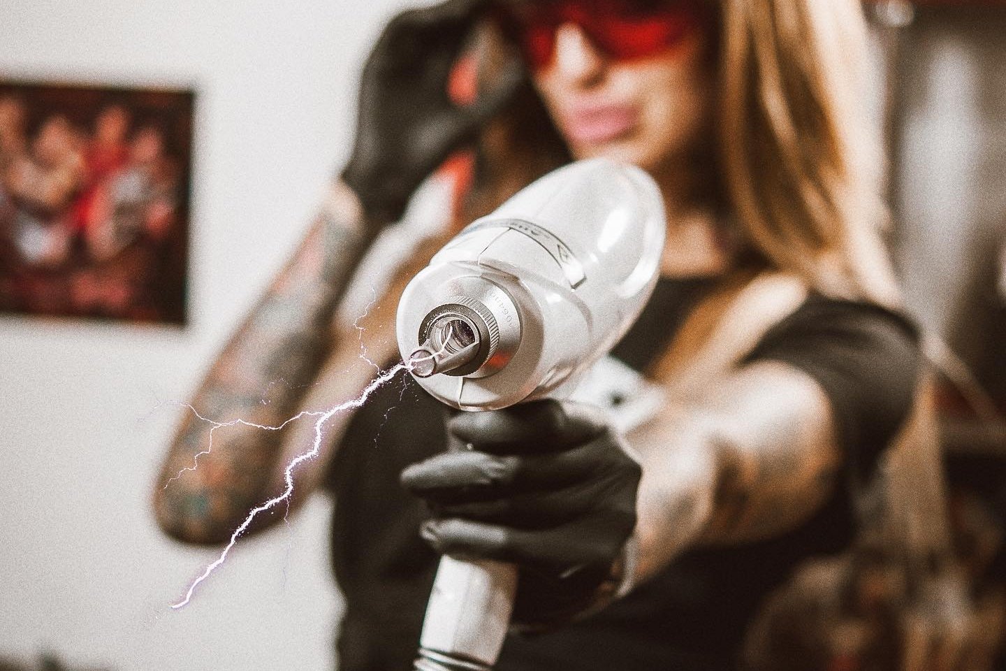 Laser permanent make-up removal in Riga