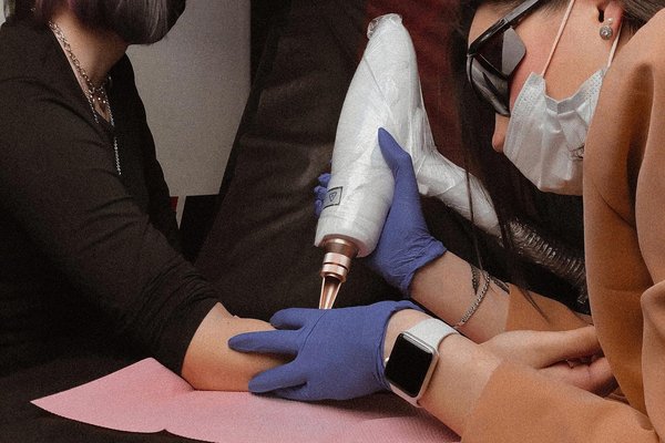 Laser tattoo removal in Liepaja