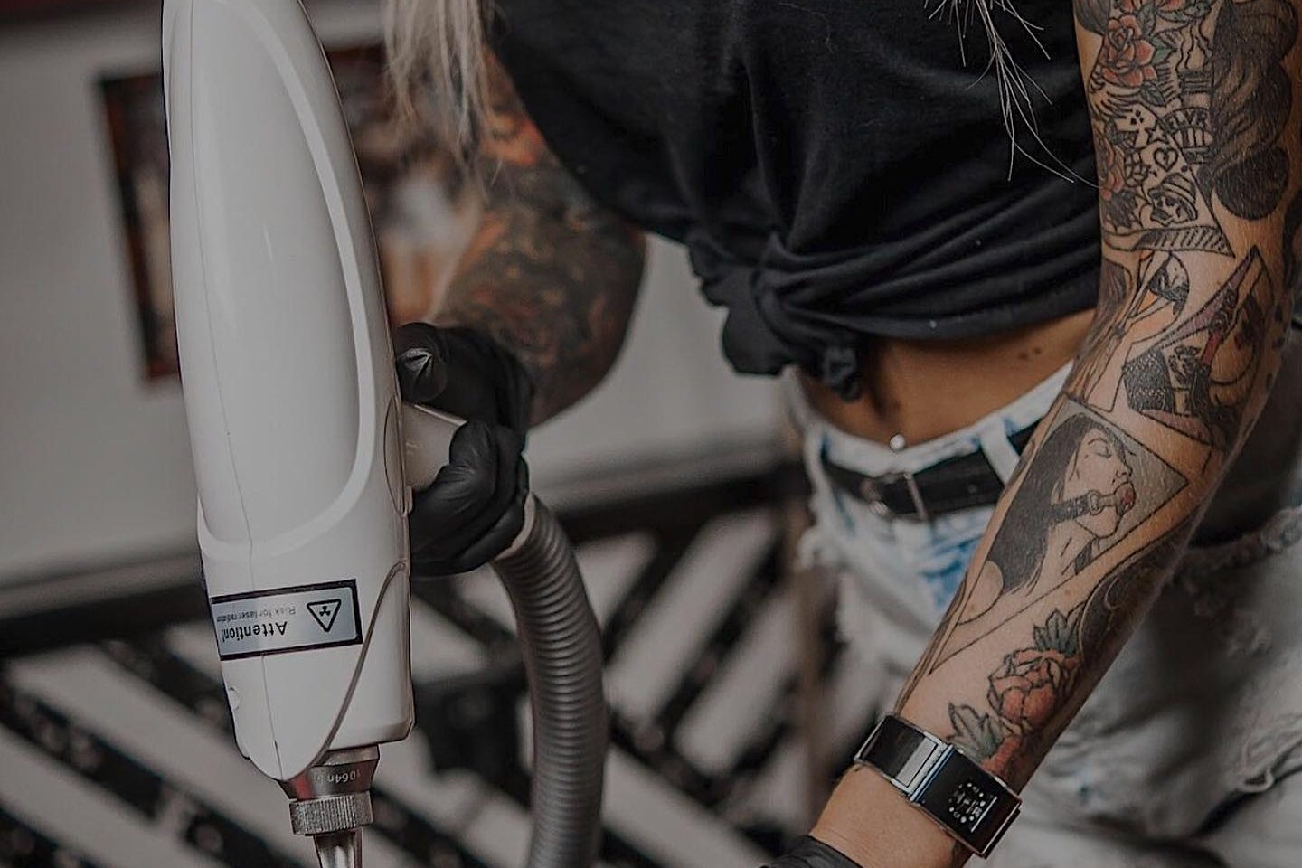 Laser tattoo removal in Riga
