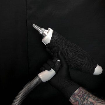 Laser tattoo removal in Liepaja