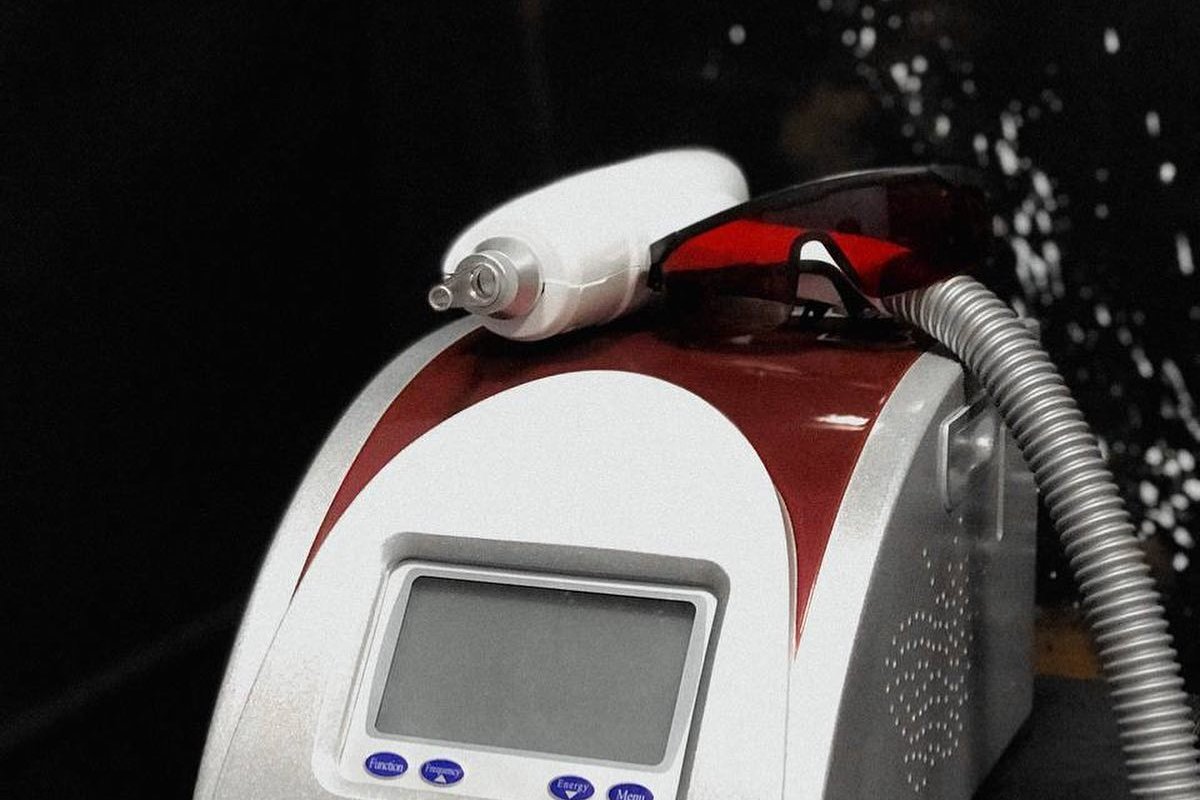 Laser tattoo removal in Liepaja