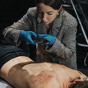 darbs ar lāzeru tetovējumu izgaismošanā