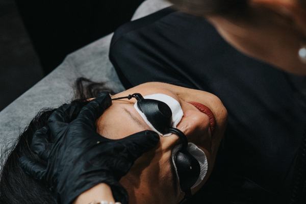 Tetovējumu izgaismošanas procedūra ar rimuveru praktiskajā apmācībā