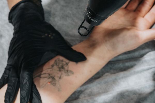 Tetovējumu lāzera izgaismošanas kurss Jelgavā