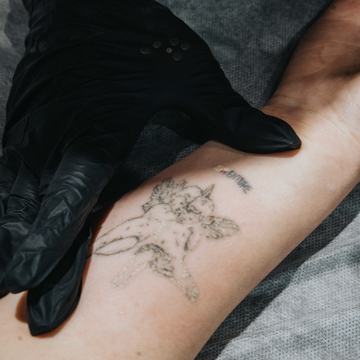 Laser tattoo lightening course