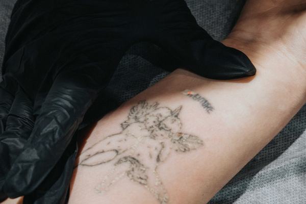 Tetovējumu izgaismošanas kurss ar rimuveriem Liepājā