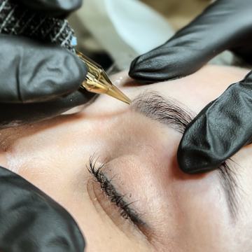 tetovējuma izgaismošana ar removeru procedūras laikā Rīgā