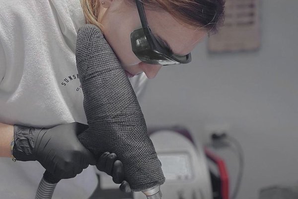Laser tattoo removal in Jurmala
