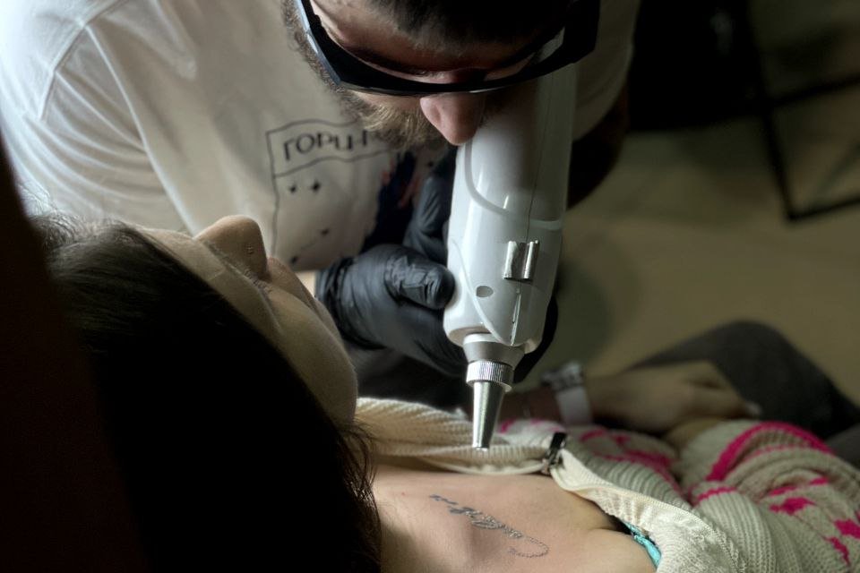 Laser tattoo removal in Jurmala