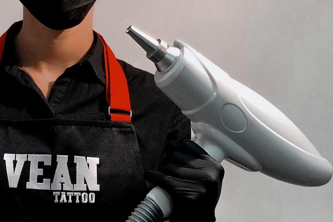 Tattoo Removal in Daugavpils