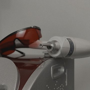 tattoo removal
