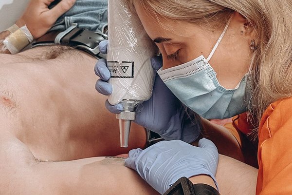 Tetovējumu dzēšana ar lāzeru Liepājā
